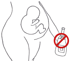 FASD Syndrom